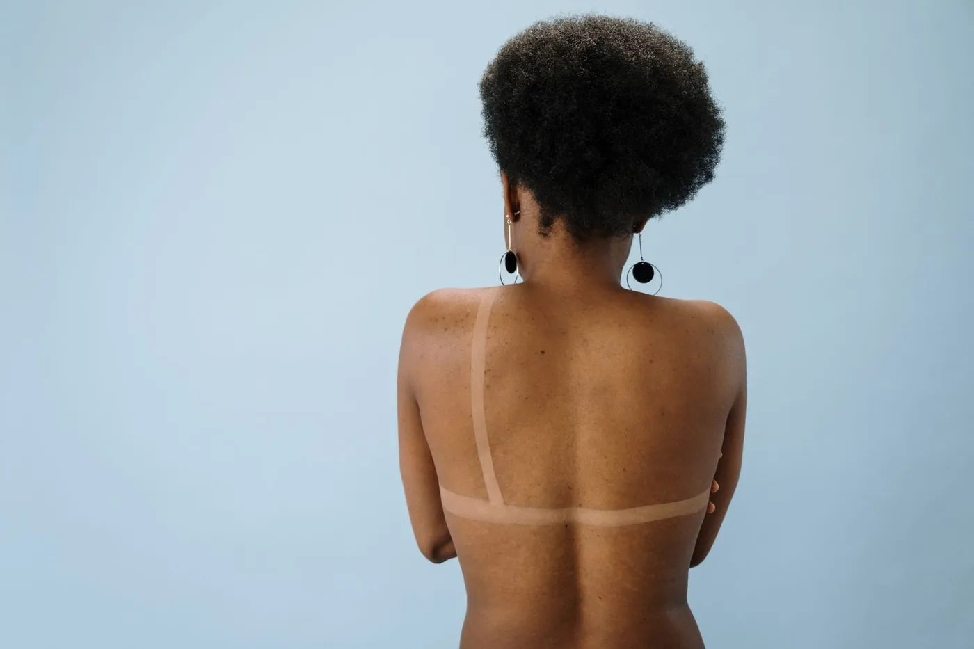 Yaz sonrası beliren açık ve koyu lekeler: güneş mantarı mı, vitiligo mu?